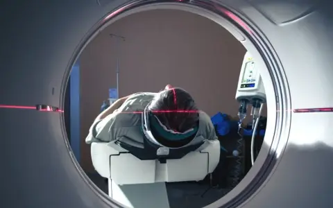 Co oznacza SUV w badaniu PET i jak wpływa na diagnozę chorób